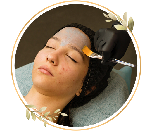 Professional acne care treatment from Trendmi helps control breakouts and improves skin clarity