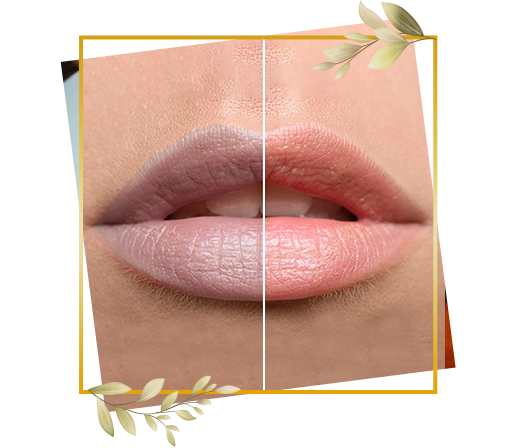 Lip tone correction service at TrendMi Salon focused on improving natural lip color and smooth texture.