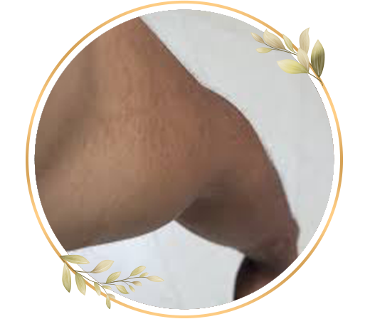 Half and full arm detan for men helps reduce tan and gives clean, even-toned and refreshed skin at TrendMi Salon