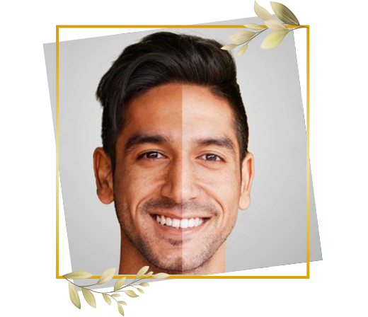 Men's detan and tan removal facial service showing noticeable skin tone correction and improved complexion balance