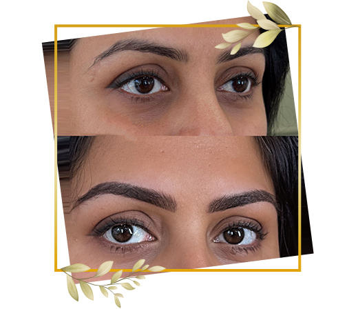 Before and after result of eyebrow microblading service at TrendMi Salon showing fuller and well-defined brows.
