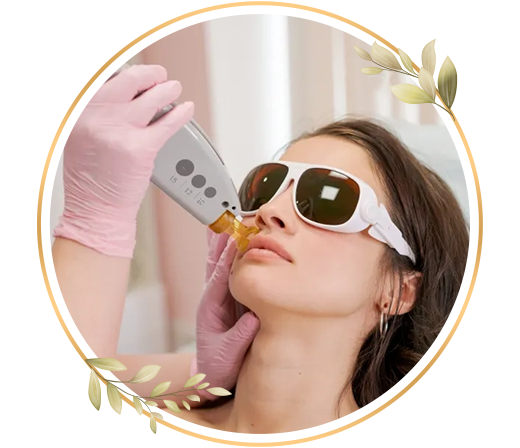 Upper lip hair removal at TrendMi to remove unwanted hair and keep skin soft and clean